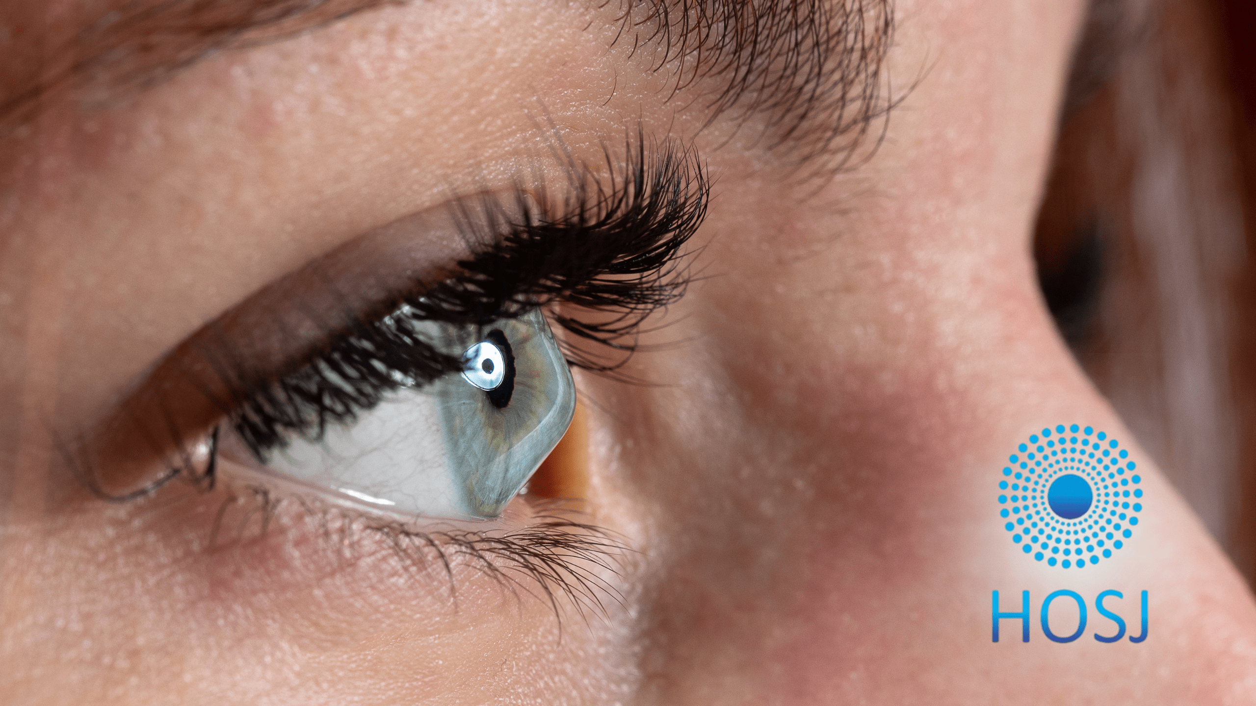 Ceratocone: sintomas, diagnóstico e tratamentos disponíveis no Hospital de Olhos de São João Del Rei