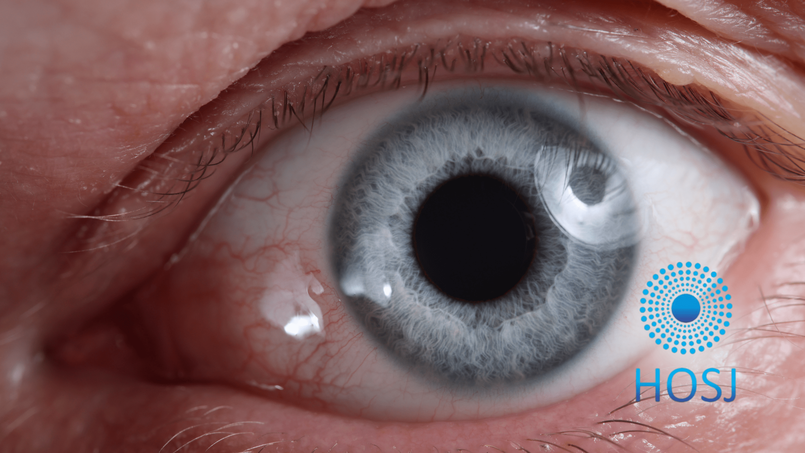 Por que a pupila é dilatada em alguns exames oftalmológicos?